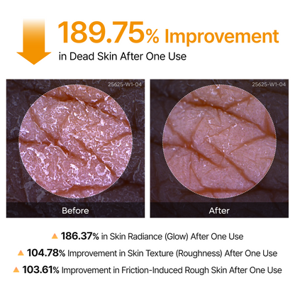 Peel Shot Kojic Acid Turmeric Spray